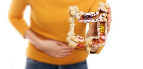 CBD e Doenças Inflamatórias Intestinais: alívio dos sintomas e qualidade de vida